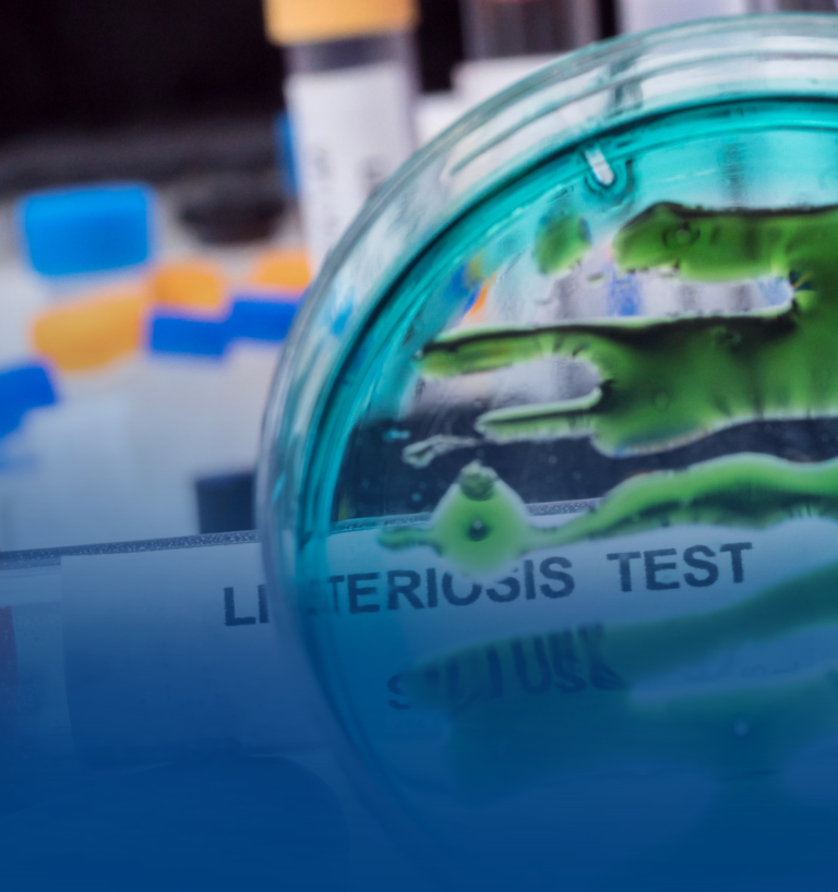 Listeria monocytogenes: un desafío permanente para las plantas de alimentos listos para el consumo